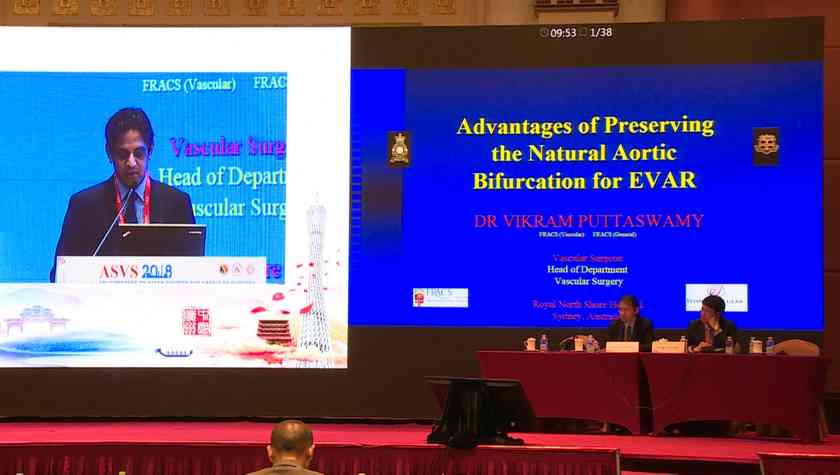 Advantages of Preserving  the Natural Aortic Bifurcation for EVER